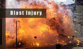 blast