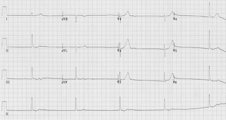 Emergency Medical Services-ecg January 2024 Issue - Emergency Medical 