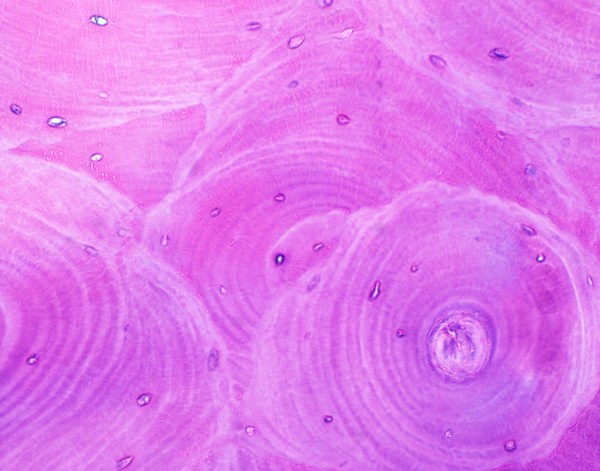 lamellar-bone