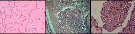 endocrine gland surgical pathology specimens