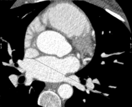 ctscan