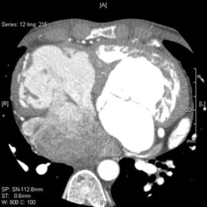 ctscan