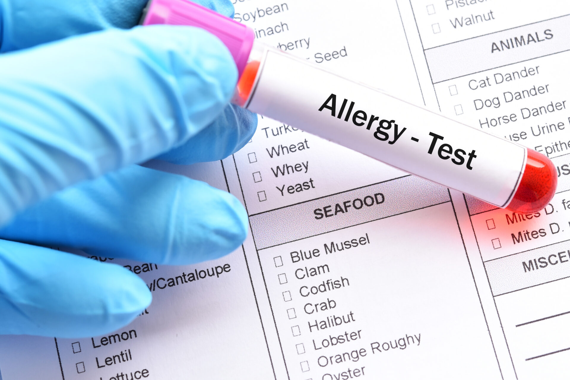 Food allergy test