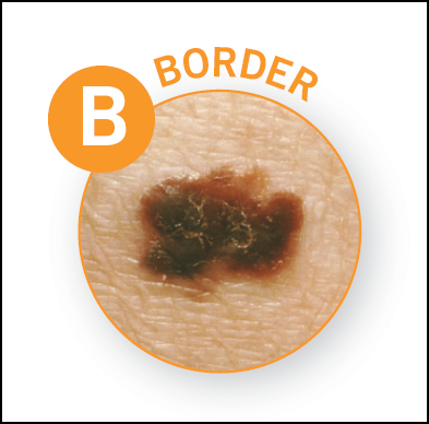 Border